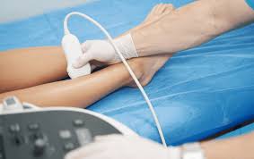 Vascular Care